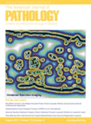 Rad znanstvenika IRB-a objavljen u The American Journal of Pathology 